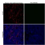 Ki-67 Antibody in Immunohistochemistry (Paraffin) (IHC (P))