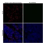 Ki-67 Antibody in Immunohistochemistry (Paraffin) (IHC (P))