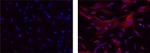 APP (Amyloid Precursor Protein) Antibody in Immunocytochemistry (ICC/IF)