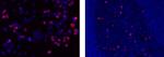 Phospho-Histone H2A.X (Ser139) Antibody in Immunocytochemistry (ICC/IF)