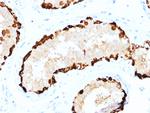 Melanoma Antigen Family A, 4/MAGEA4 Antibody in Immunohistochemistry (Paraffin) (IHC (P))