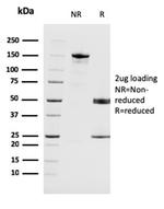 Melanoma Antigen Family A, 4/MAGEA4 Antibody in SDS-PAGE (SDS-PAGE)