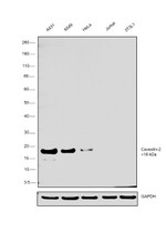 Caveolin 2 Antibody in Western Blot (WB)