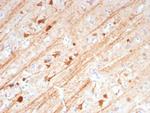 MAP2 Antibody in Immunohistochemistry (Paraffin) (IHC (P))