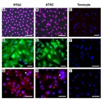 SSEA4 Antibody in Immunocytochemistry, Immunohistochemistry (ICC/IF, IHC)