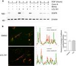 EGFR Antibody in Western Blot (WB)