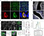 RAB5 Antibody in Immunohistochemistry (IHC)