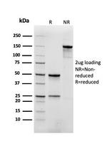 Myoglobin Antibody in SDS-PAGE (SDS-PAGE)