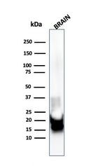 Myelin Basic Protein Antibody in Western Blot (WB)