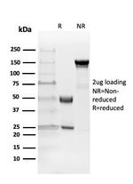 Myelin Basic Protein Antibody in SDS-PAGE (SDS-PAGE)