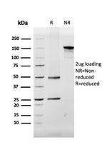 Myelin Basic Protein Antibody in SDS-PAGE (SDS-PAGE)