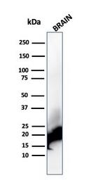 Myelin Basic Protein Antibody in Western Blot (WB)