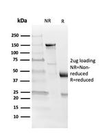 Myelin Basic Protein Antibody in SDS-PAGE (SDS-PAGE)