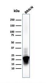 Myelin Basic Protein Antibody in Western Blot (WB)