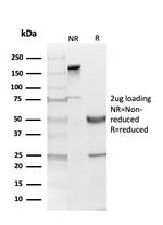 Myelin Basic Protein Antibody in SDS-PAGE (SDS-PAGE)