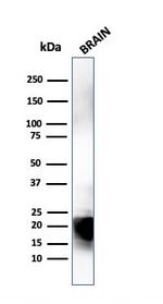 Myelin Basic Protein Antibody in Western Blot (WB)