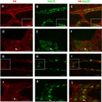 HuC/HuD Antibody in Immunohistochemistry (IHC)