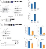 BRCA1 Antibody in Western Blot (WB)