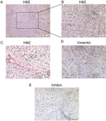 Vimentin Antibody in Immunohistochemistry (IHC)