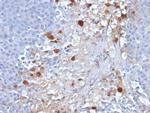 MCAM (Melanoma Cell Adhesion Molecule)/MUC18/CD146 Antibody in Immunohistochemistry (Paraffin) (IHC (P))