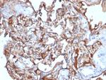 MCAM (Melanoma Cell Adhesion Molecule)/MUC18/CD146 Antibody in Immunohistochemistry (Paraffin) (IHC (P))