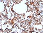 MCAM (Melanoma Cell Adhesion Molecule)/MUC18/CD146 Antibody in Immunohistochemistry (Paraffin) (IHC (P))