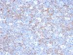 MCAM (Melanoma Cell Adhesion Molecule)/MUC18/CD146 Antibody in Immunohistochemistry (Paraffin) (IHC (P))