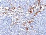 MCAM (Melanoma Cell Adhesion Molecule)/MUC18/CD146 Antibody in Immunohistochemistry (Paraffin) (IHC (P))