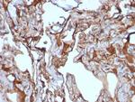 MCAM (Melanoma Cell Adhesion Molecule)/MUC18/CD146 Antibody in Immunohistochemistry (Paraffin) (IHC (P))