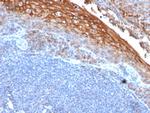 MCAM (Melanoma Cell Adhesion Molecule)/MUC18/CD146 Antibody in Immunohistochemistry (Paraffin) (IHC (P))