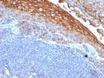 MCAM (Melanoma Cell Adhesion Molecule)/MUC18/CD146 Antibody in Immunohistochemistry (Paraffin) (IHC (P))