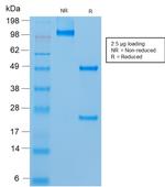 MCAM (Melanoma Cell Adhesion Molecule)/MUC18/CD146 Antibody in SDS-PAGE (SDS-PAGE)