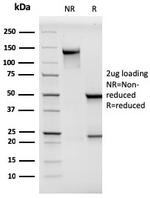 MCAM (Melanoma Cell Adhesion Molecule)/MUC18/CD146 Antibody in SDS-PAGE (SDS-PAGE)