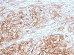 MCAM (Melanoma Cell Adhesion Molecule)/MUC18/CD146 Antibody in Immunohistochemistry (Paraffin) (IHC (P))