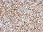 MCAM (Melanoma Cell Adhesion Molecule)/MUC18/CD146 Antibody in Immunohistochemistry (Paraffin) (IHC (P))