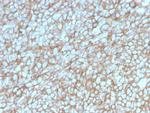 MCAM (Melanoma Cell Adhesion Molecule)/MUC18/CD146 Antibody in Immunohistochemistry (Paraffin) (IHC (P))