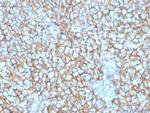 MCAM (Melanoma Cell Adhesion Molecule)/MUC18/CD146 Antibody in Immunohistochemistry (Paraffin) (IHC (P))