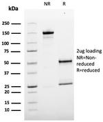 MCAM (Melanoma Cell Adhesion Molecule)/MUC18/CD146 Antibody in SDS-PAGE (SDS-PAGE)