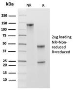 MCM2 (ProliferationMarker) Antibody in SDS-PAGE (SDS-PAGE)