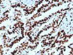 MCM2 (Proliferation Marker) Antibody in Immunohistochemistry (Paraffin) (IHC (P))