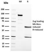 MCM6 Antibody in SDS-PAGE (SDS-PAGE)