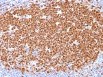 MCM7 (Proliferation Marker) Antibody in Immunohistochemistry (Paraffin) (IHC (P))