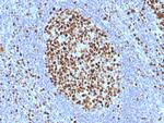 MCM7/CDC47 (Proliferation Marker) Antibody in Immunohistochemistry (Paraffin) (IHC (P))