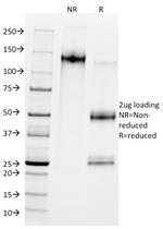 MDM2 Antibody in SDS-PAGE (SDS-PAGE)