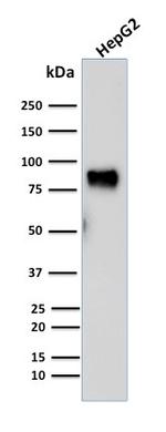 MDM2 Antibody in Western Blot (WB)