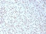 MDM2 Antibody in Immunohistochemistry (Paraffin) (IHC (P))