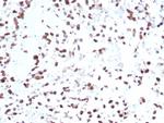 MDM2 Antibody in Immunohistochemistry (Paraffin) (IHC (P))