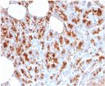 MDM2 Antibody in Immunohistochemistry (Paraffin) (IHC (P))