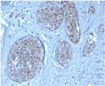 MDM2 Antibody in Immunohistochemistry (Paraffin) (IHC (P))