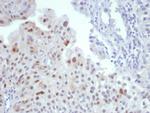 MDM2 Antibody in Immunohistochemistry (Paraffin) (IHC (P))